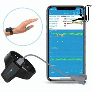 مانیتور اکسیژن خون Checkme
